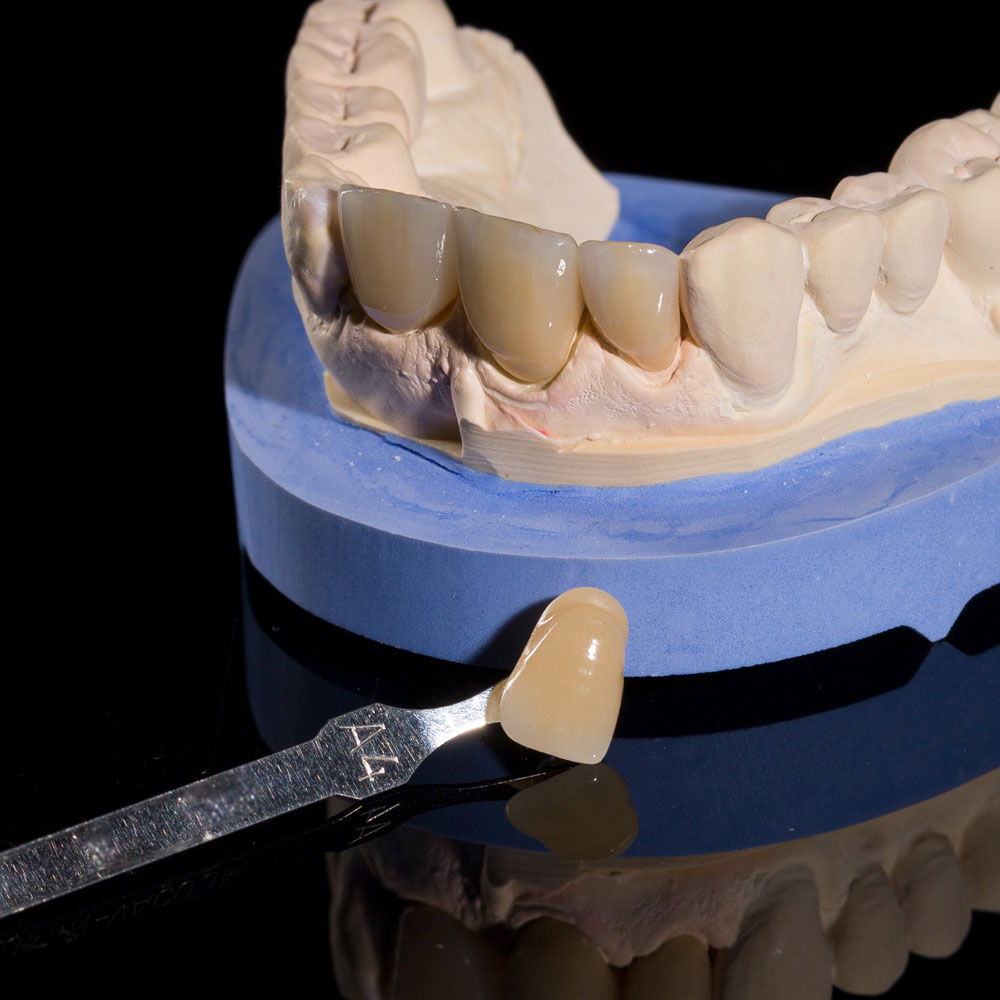 Services_Service_custom-shades Services_Service_custom-shades