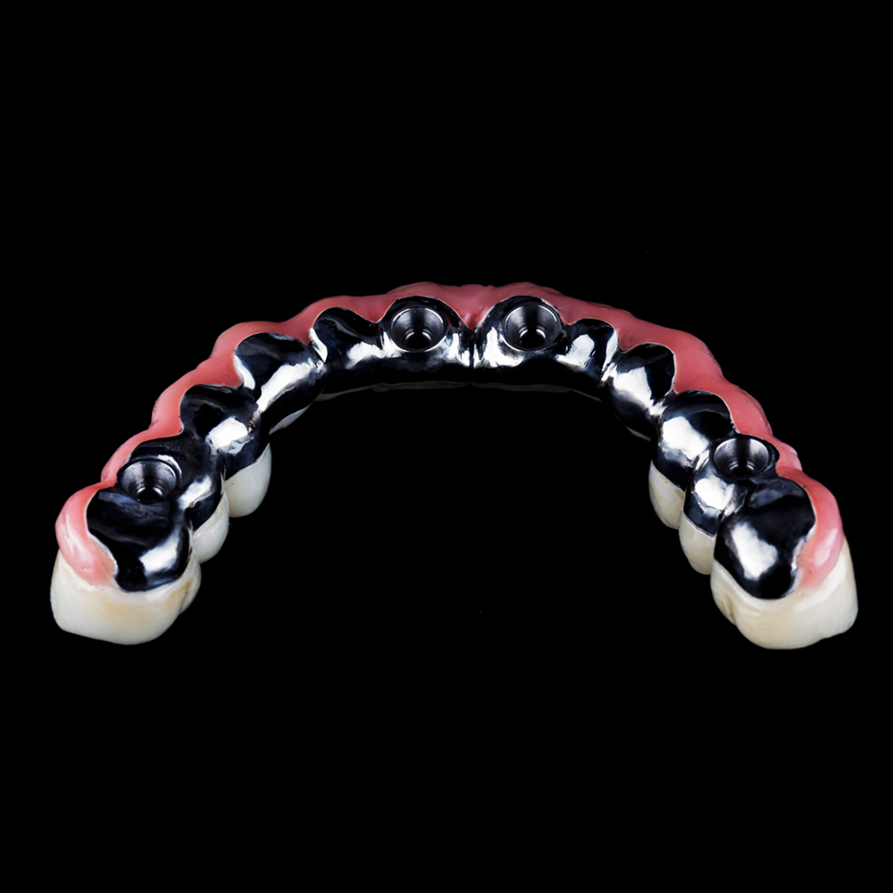 Services_Service_implants Services_Service_implants