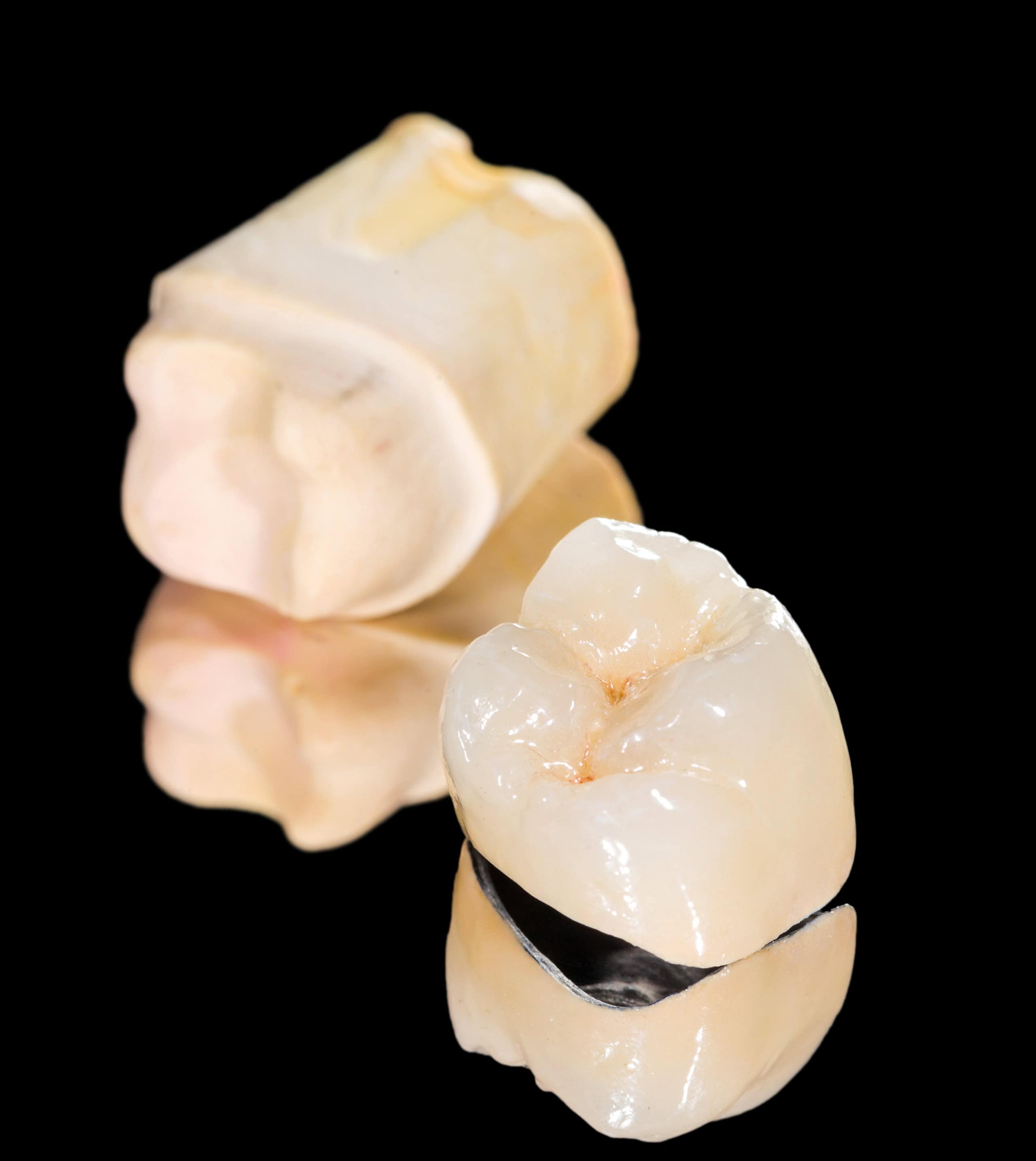 Ceramic crown Metal ceramic crown on isolated black background